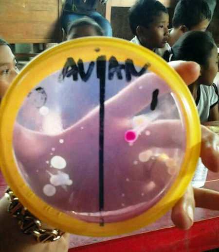 Workshop participant examining E.coli contaminated sample inside a sealed petridish