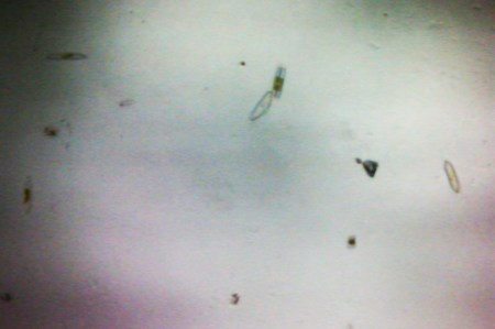 diatoms 1